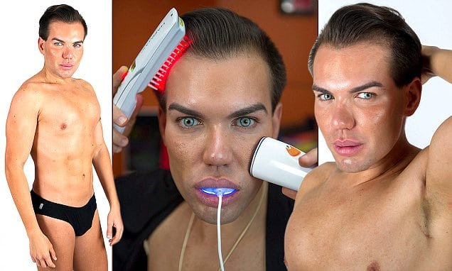 Rodrigo Alves spends $8000 on new plastic surgery to look like Ken doll.