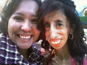 Lizzie Velasquez has to eat every 15 minutes or she will die.
