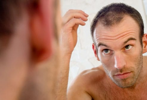 Male Pattern Baldness, Reviewв„ў - Body Hair Removal,Health,Beauty
