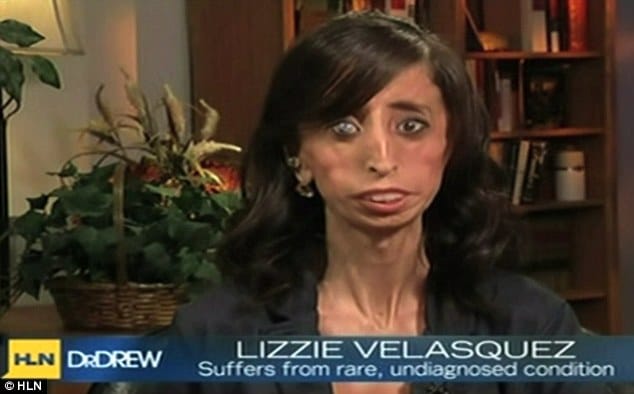 Worlds Ugliest Woman Gives Interview Would Not Want To Look Like A 
