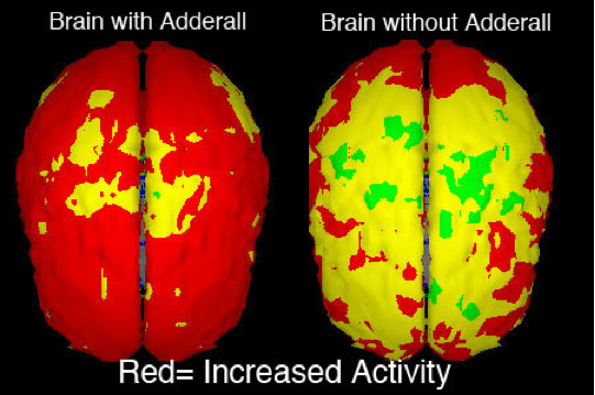 Adderall's effect on the brain.