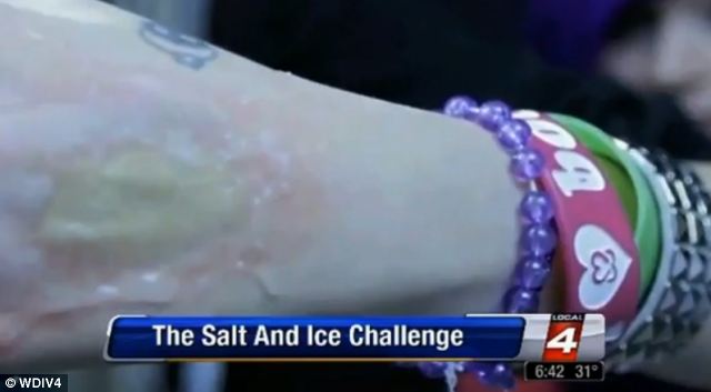 Salt and ice burn challenge