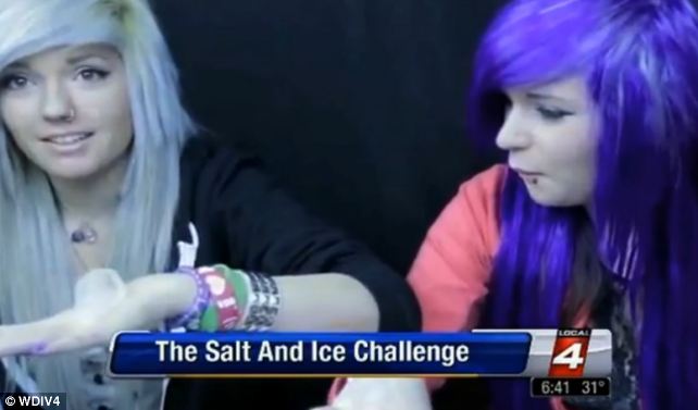 Salt and ice burn challenge.