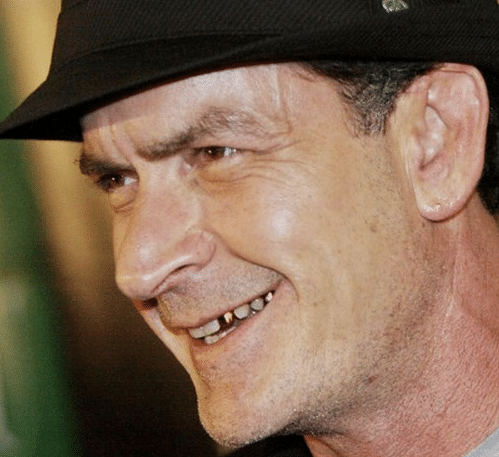 Charlie Sheen crack teeth