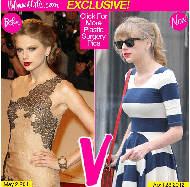 Oh Really Taylor Swift Gets Breast Implant