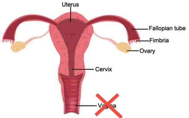 vagina vagina