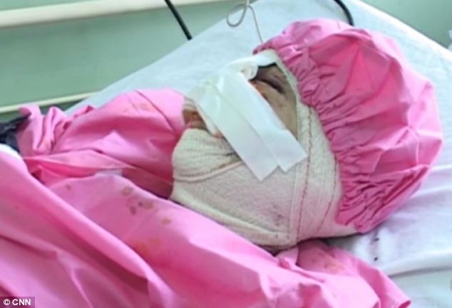Afghan woman's nose and lips cut off 