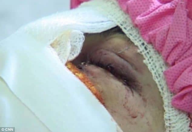 Afghan woman's nose and lips cut off 