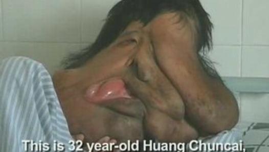 China's Elephant man