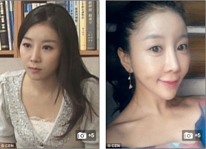 South Korean reporter shocks nation with drastic jaw surgery. Did she