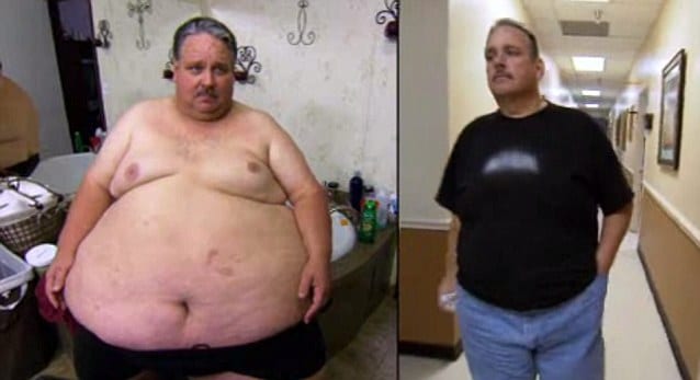 Chuck Turner weight loss surgery