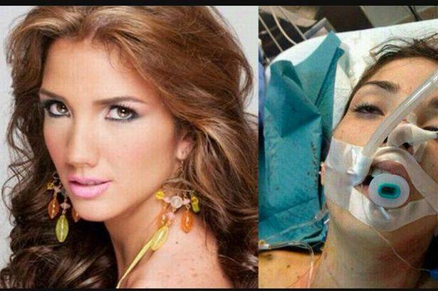 Venezuelan beauty queen Genesis Carmona dead