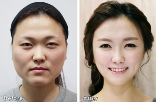 Plastic surgery in South Korea 