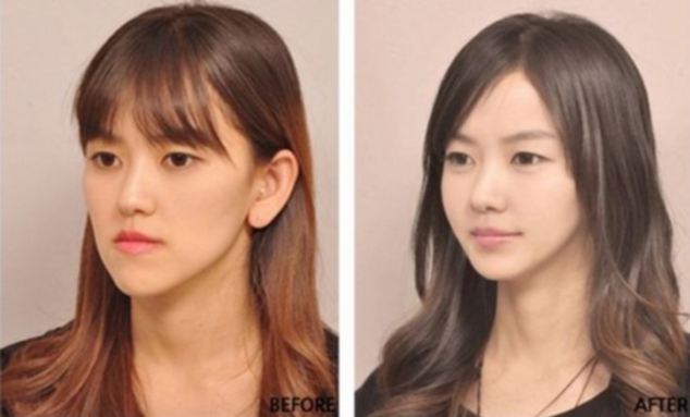 Plastic surgery in South Korea 