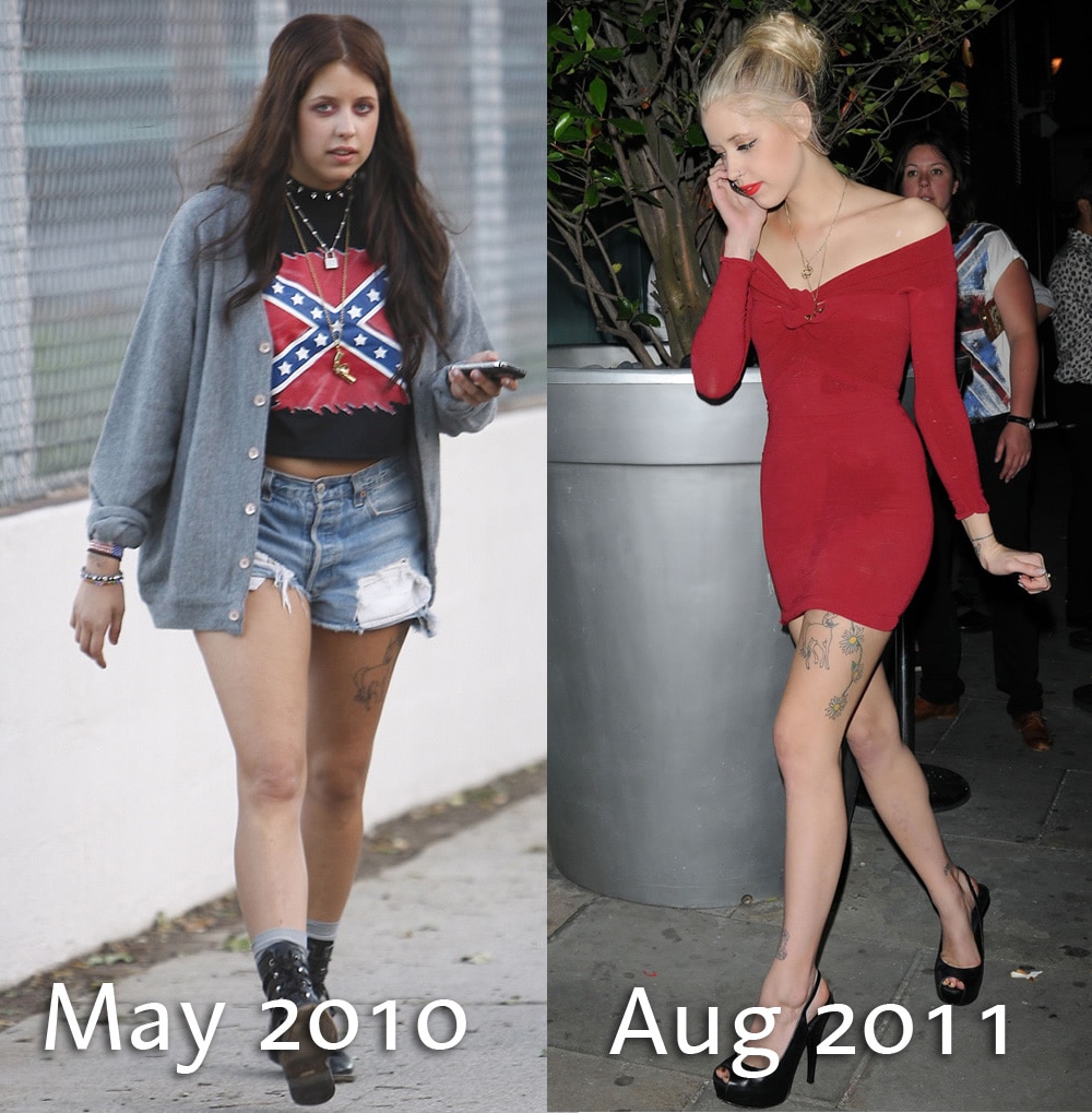 Was Peaches Geldof In The Grips Of Anorexia 