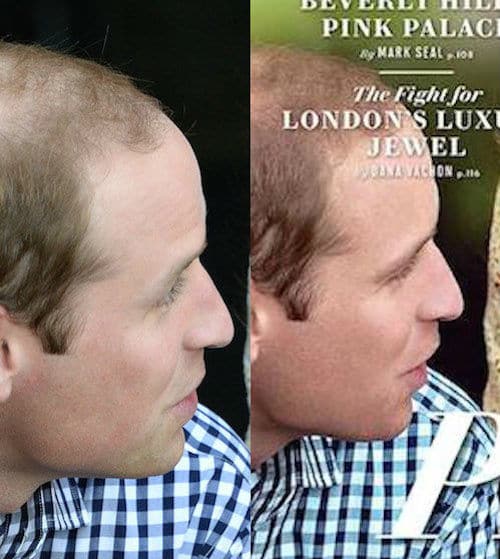 Vanity Fair photoshops Prince William's thinning hair