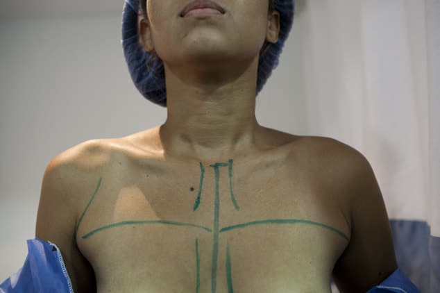 Venezuela shortage of breast implants