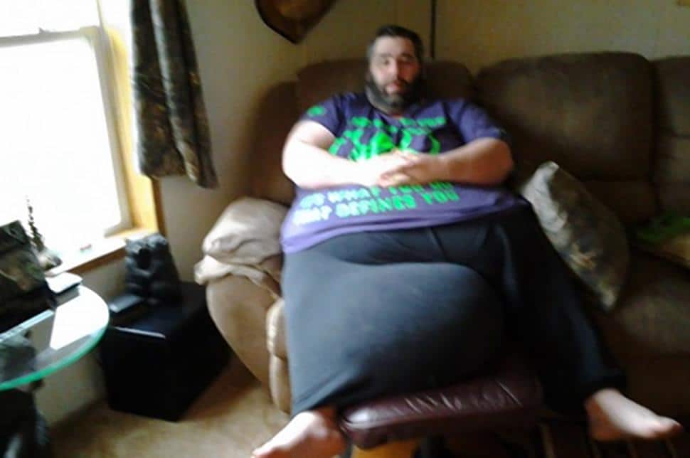 Dan Maurer has 100 pound scrotum removed