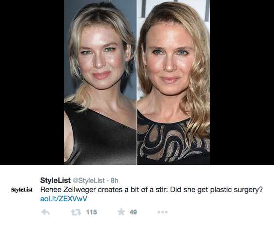 Renee Zellweger plastic surgery