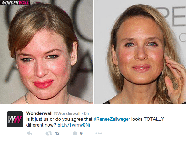 Renee Zellweger plastic surgery