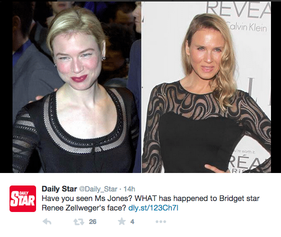 Renee Zellweger plastic surgery