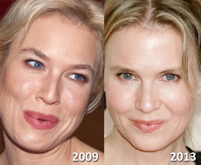 Renee Zellweger plastic surgery. Damned if she does ...