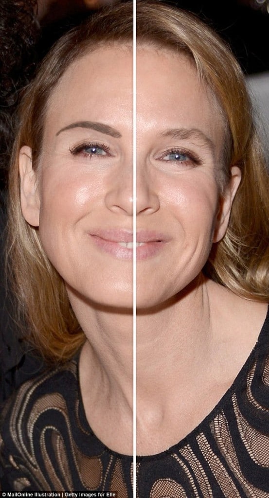 Renee Zellweger plastic surgery