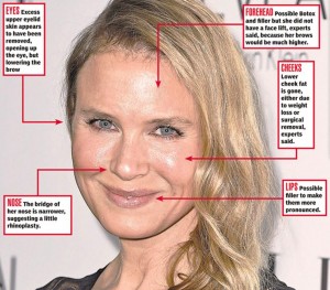 Renee Zellweger new face. Denies plastic surgery. Do you believe her?