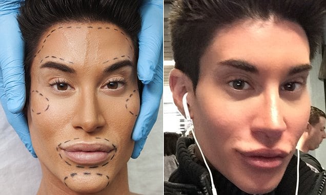 man who wants to be a ken doll