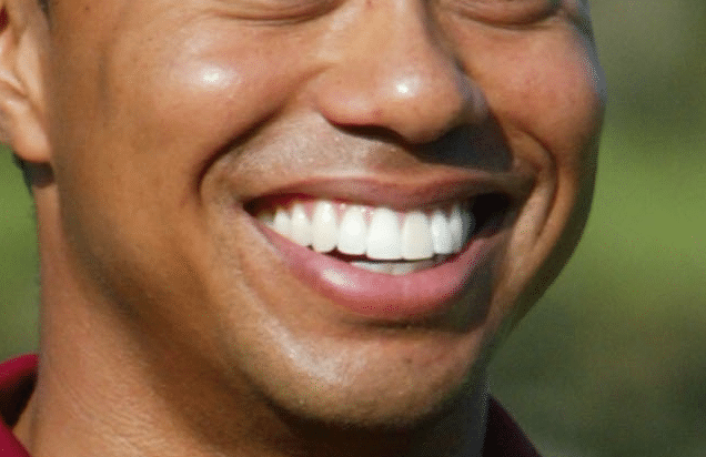Tiger Woods without his fake front tooth