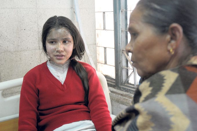Nepalese schoolgirls acid attack