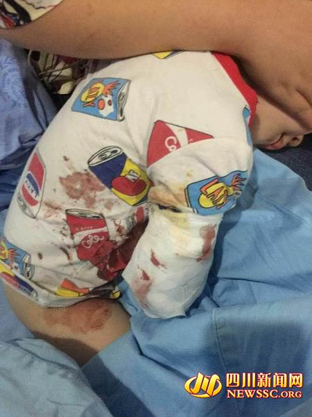 2 year old Chinese boy gets arm bitten off by white tiger