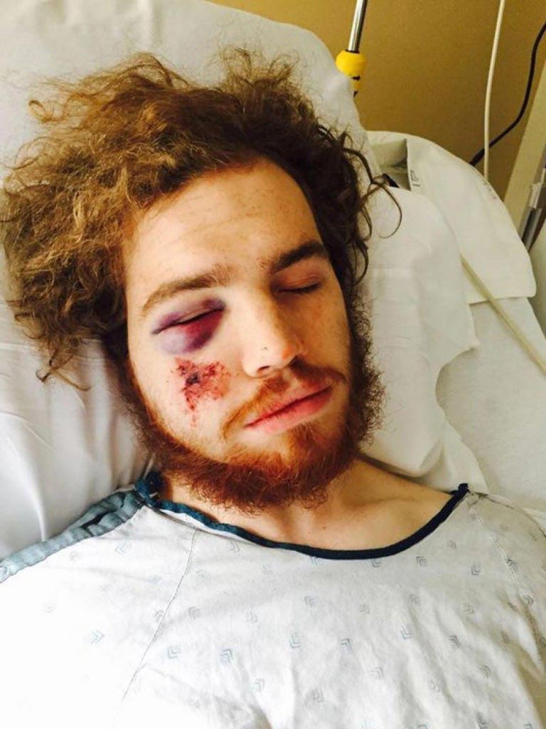 Mackenzie Jensen, Minnesota cyclist battered