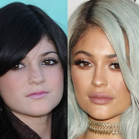 Kylie Jenner beauty regiment plastic surgery