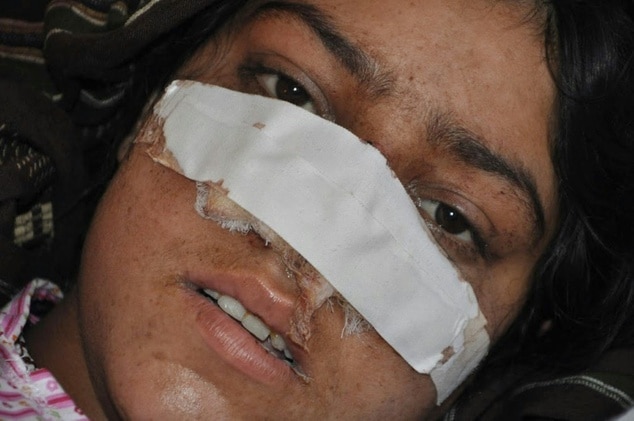 Reza Gul Afghan woman nose cut off