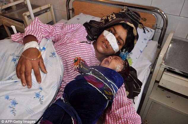 Reza Gul Afghan woman nose cut off