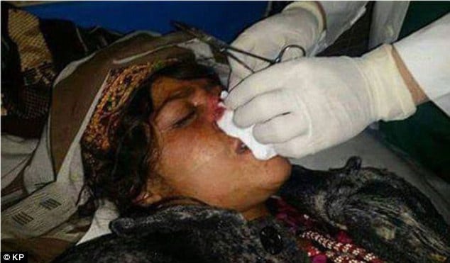 Reza Gul Afghan woman nose cut off