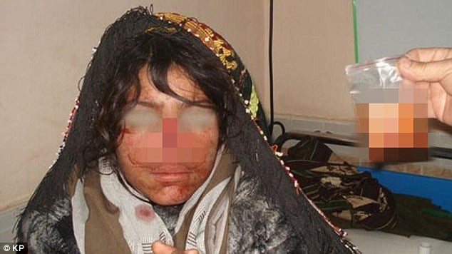 Reza Gul Afghan woman nose cut off