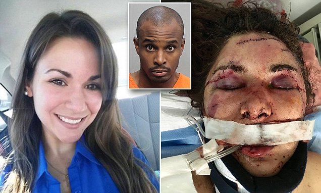 Nsfw Danielle Jones Still In Coma After Craigslist Roommate Beating 