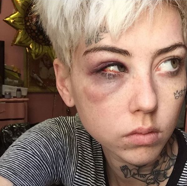 Illma Gore beaten Donald Trump supporter