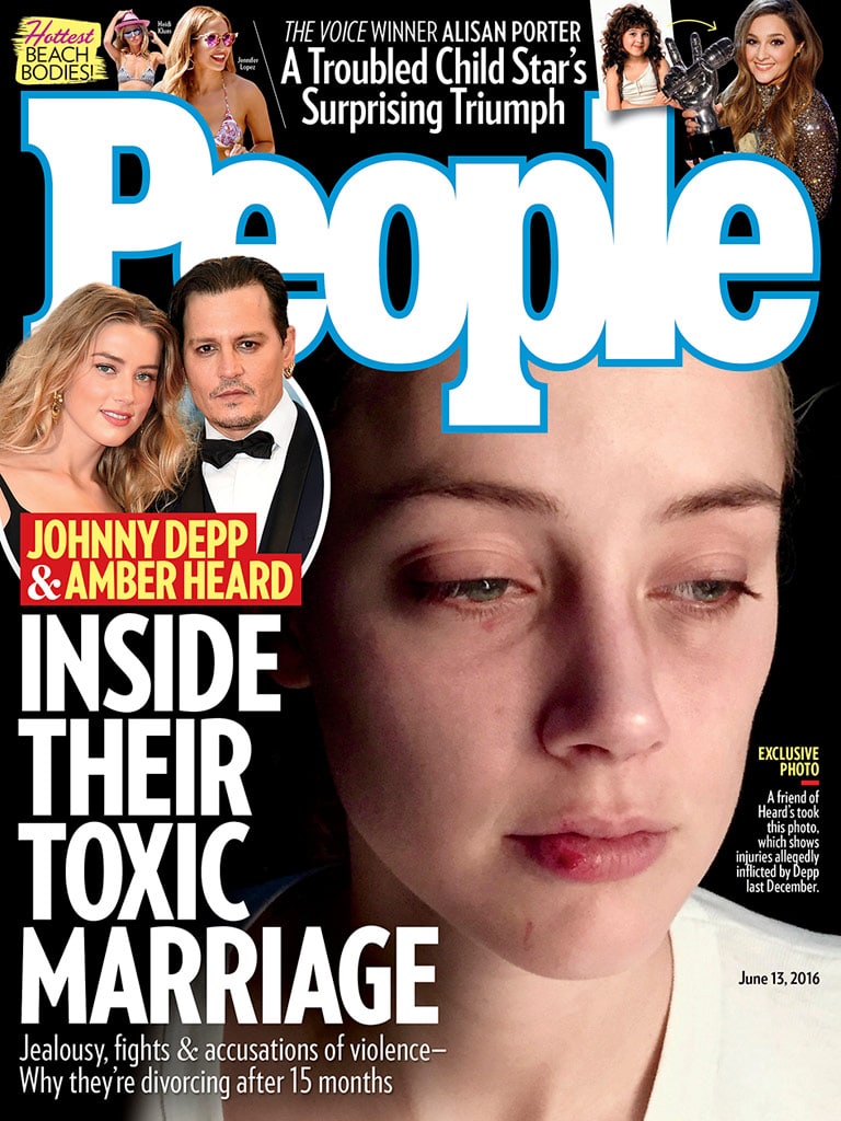 Amber Heard new abuse photos: Johnny Depp has long domestic violence history