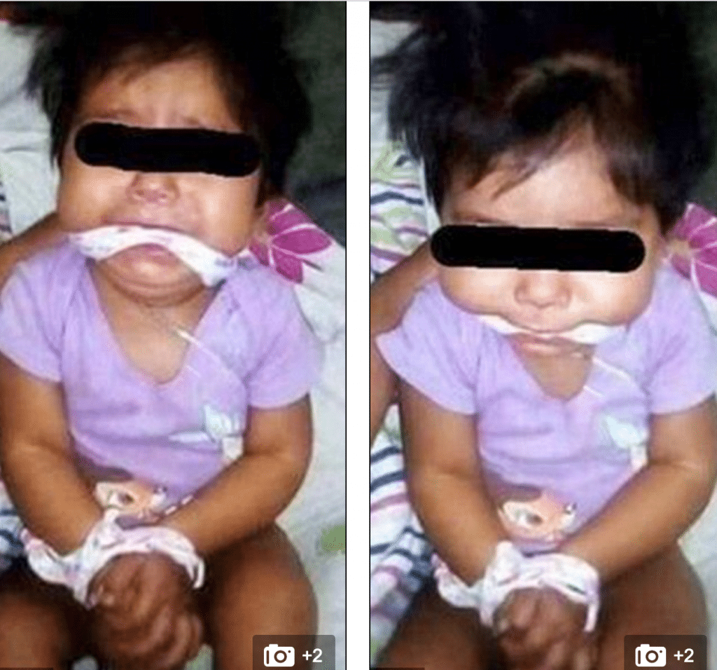 Mexican baby girl gagged facebook