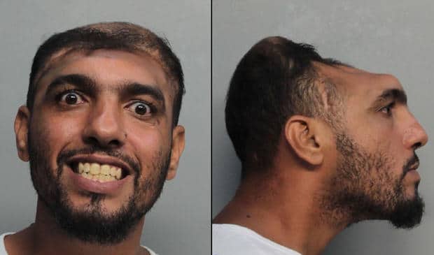 Carlos Rodriguez half headed Florida man