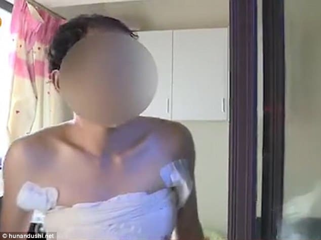 Unemployed Chinese man gets breasts implants