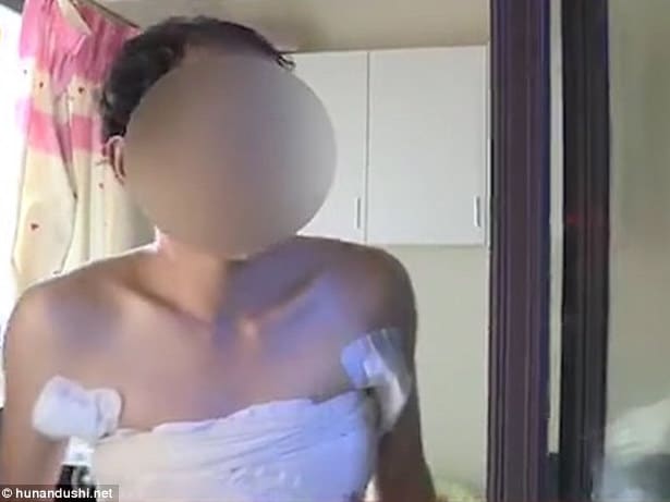 Unemployed Chinese man gets breasts implants