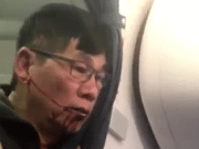 Lawsuit? David Dao doctor dragged off United files court papers preserving evidence David Dao United Airlines files court papers preserving evidence