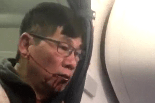 United Airlines removes Asian doctor