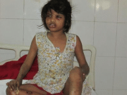 Who is Indian Mowgli girl? Raised by monkeys, grunts and walks on all fours Mowgli girl