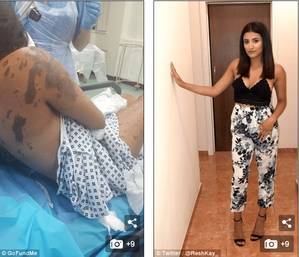 Why? Resham Khan and Jameel Muhktar endure random acid attack during ...