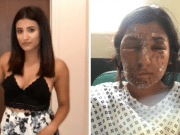 Why? Resham Khan and Jameel Muhktar endure random acid attack during 21st birthday Resham Khan